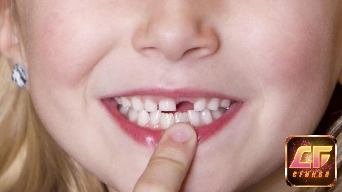 Mơ thấy gãy răng có ý nghĩa gì? Giải đáp